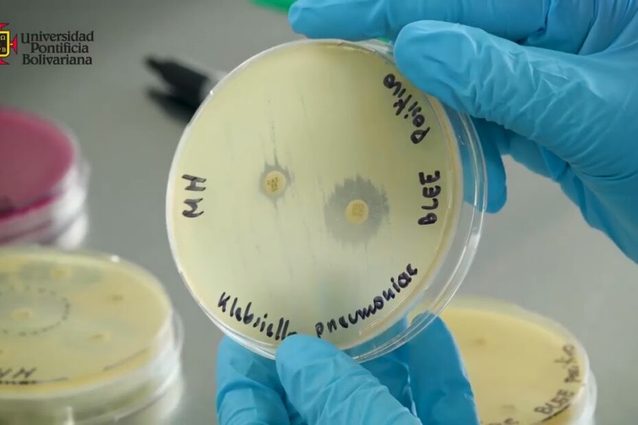 instalación de mecanismos antibacterianos